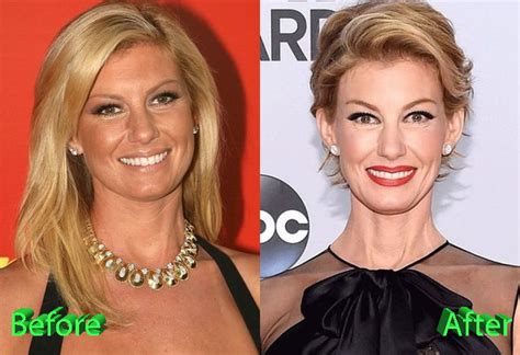 has faith hill had plastic surgery|Exploring Faith Hill’s Plastic Surgery: Myths and Realities